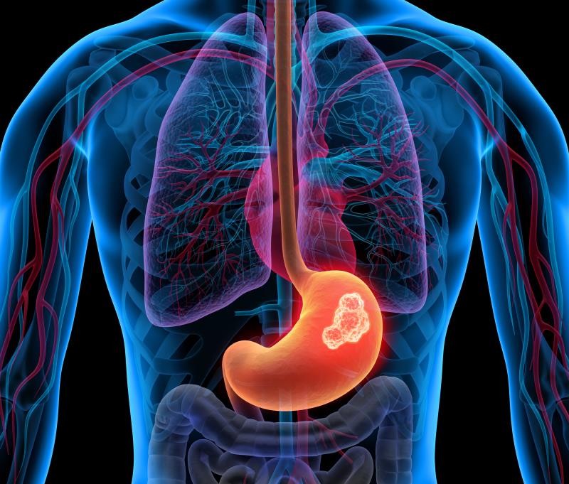 Ramucirumab plus paclitaxel prolongs survival in metastatic gastric/lower oesophageal cancer