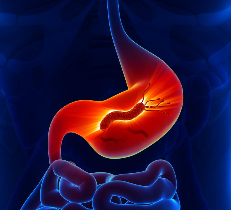 H pylori a usual finding during endoscopy for other paediatric GI diseases