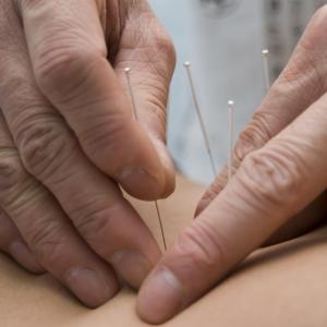 Sham acupuncture improves symptoms, QoL in functional dyspepsia