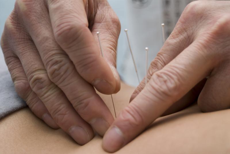 Acupuncture is a viable alternative, especially for patients who are unable to take pain-relieving drugs due to medical condi