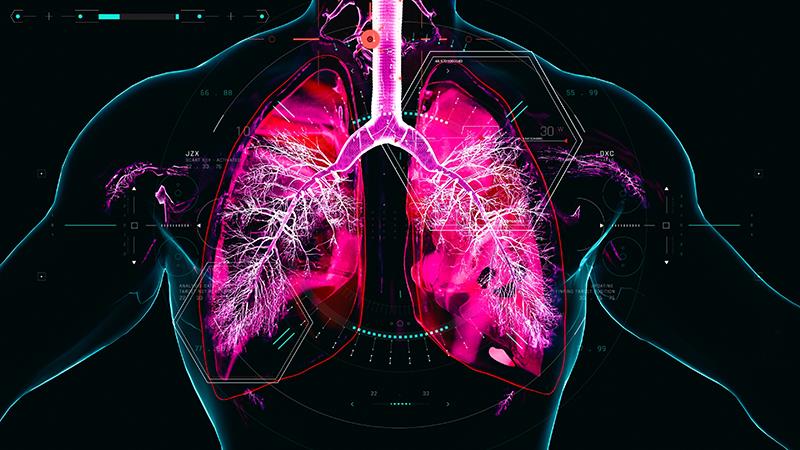 Triple therapy improves health status of COPD patients in real-world setting