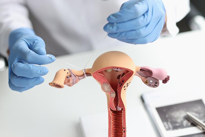 Tubal sterilization fails often enough, study says