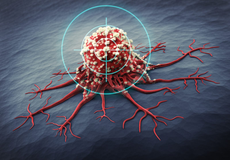 Targeting the right cavities: Localized chemotherapy for abdominal cancers