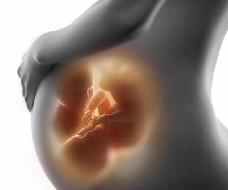 Cervical cerclage prevents preterm birth in twin pregnancies