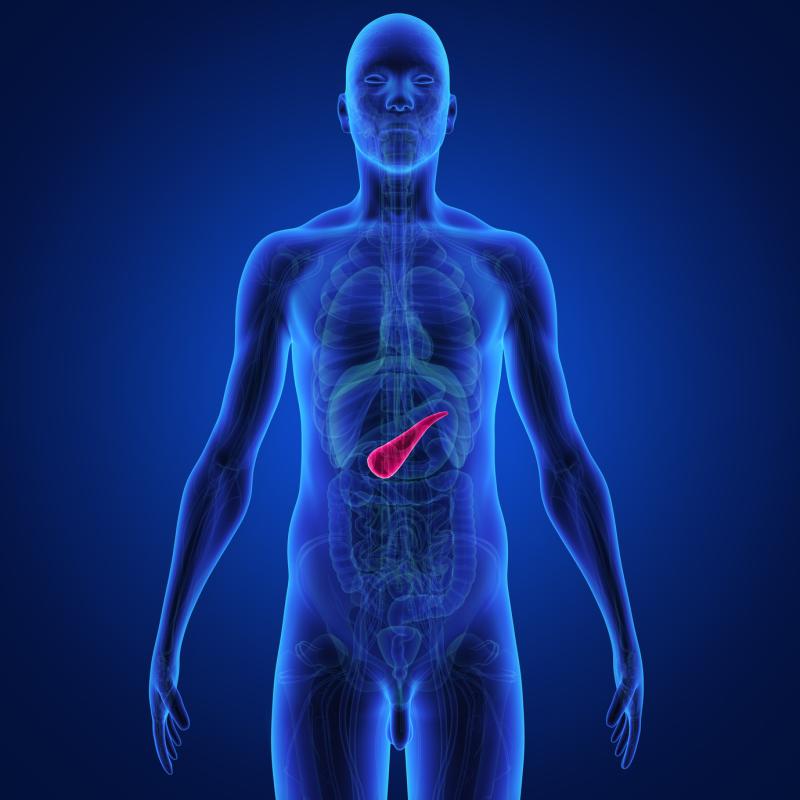 Type 3c diabetes is caused by injury to the pancreas, and is often misdiagnosed as type 2 diabetes.