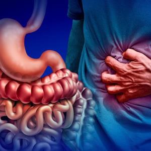 New UC guideline endorses early use of advanced therapies
