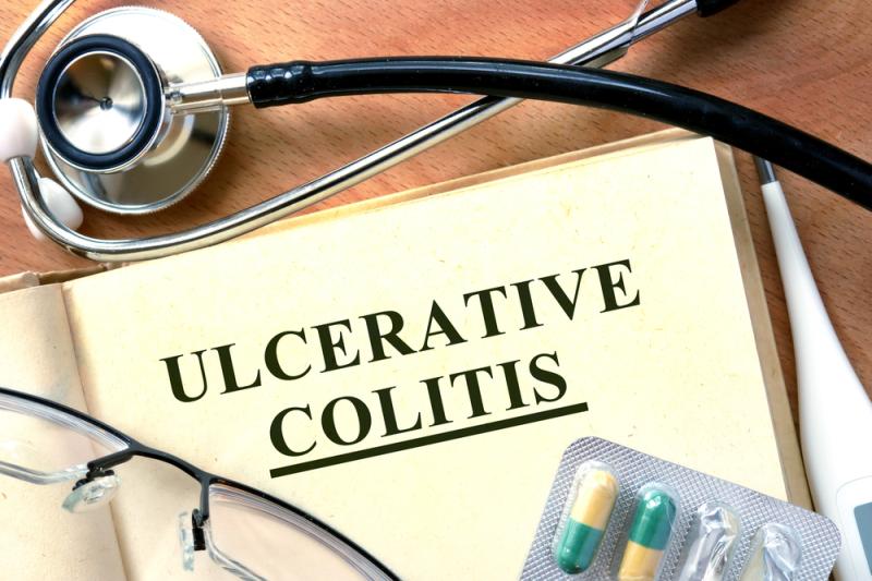 Mirikizumab confers clinical benefit in ulcerative colitis