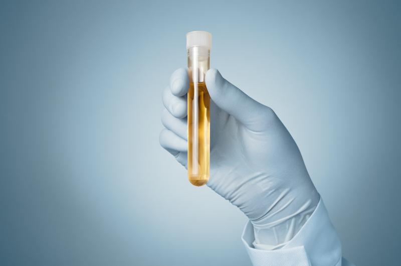 Positive urine culture tied to postsurgery infections