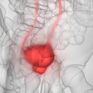 Erdafitinib on par with pembrolizumab in metastatic urothelial cancer