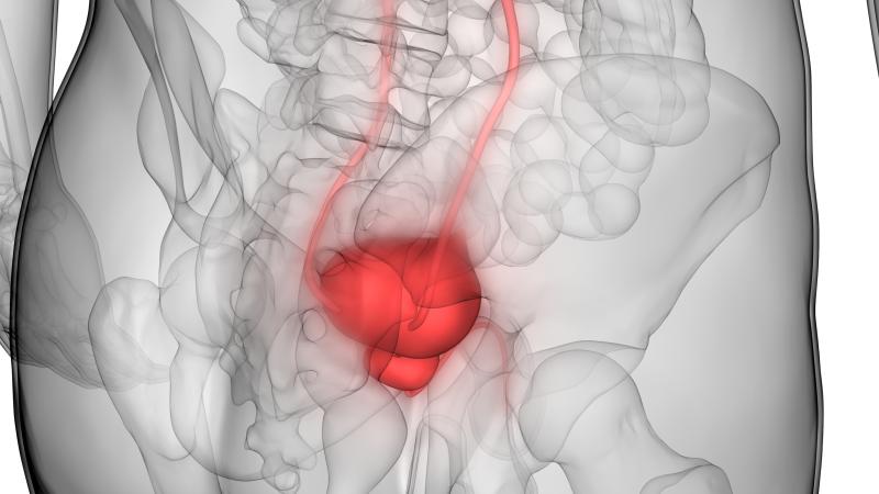 Erdafitinib on par with pembrolizumab in metastatic urothelial cancer