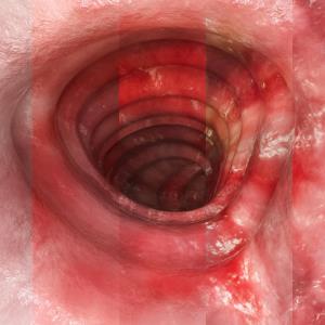 Subcutaneous CT-P13 performs similarly to intravenous administration