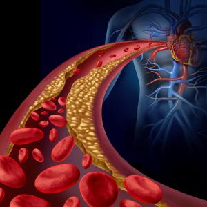 LDL-C levels do not predict ischaemic stroke in AF patients on DOACs