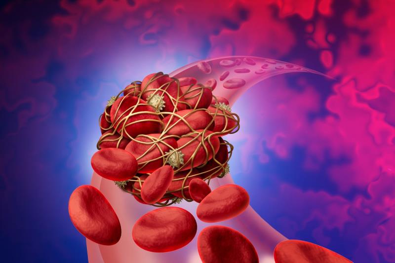 Practical considerations in the choice of pharmacological therapy (VKAs vs NOACs) for venous thromboembolism