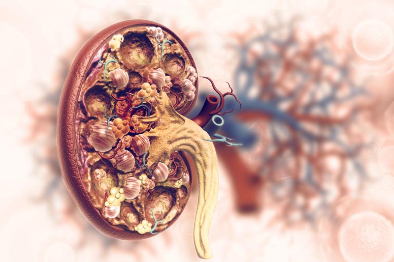 Obinutuzumab for lupus nephritis prevents flares while preserving kidney function