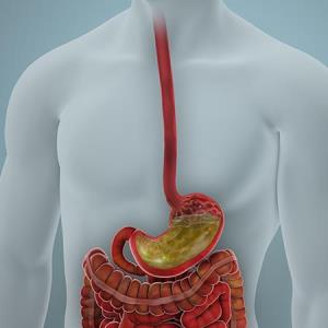 Vonoprazan trumps PPIs for treatment of grade C/D esophagitis