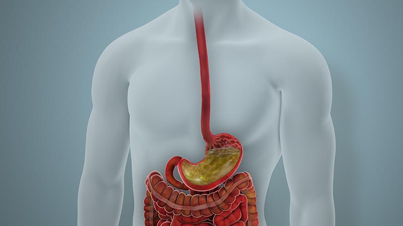 Vonoprazan trumps PPIs for treatment of grade C/D esophagitis
