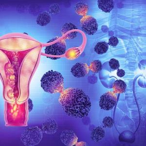 Endometrial cancer in women under 40 years of age