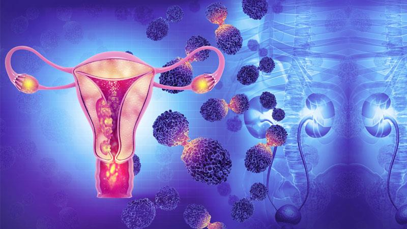 Endometrial cancer in women under 40 years of age