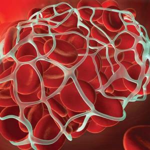 Do GLP-1 RAs reduce VTE risk in T2D?