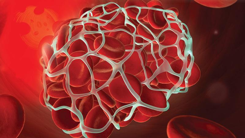 Do GLP-1 RAs reduce VTE risk in T2D?