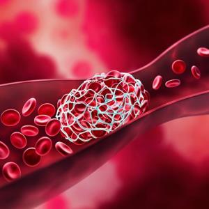 Dữ liệu đời thực ủng hộ các thuốc DOAC hơn warfarin trong điều trị VTE