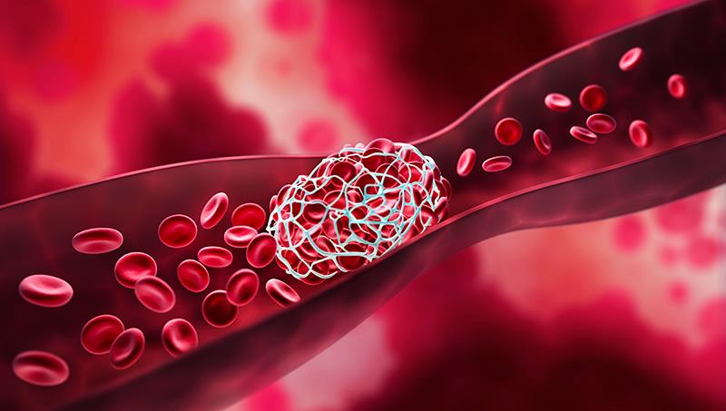 Dữ liệu đời thực ủng hộ các thuốc DOAC hơn warfarin trong điều trị VTE