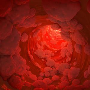 Vupanorsen reduces non-HDL-C levels in adults with hyperlipidaemia already on statins