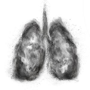 Serplulimab-chemo shows promise for squamous NSCLC