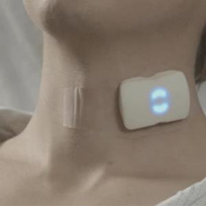 Wearable patch tracks Doppler blood flow metrics in carotid artery