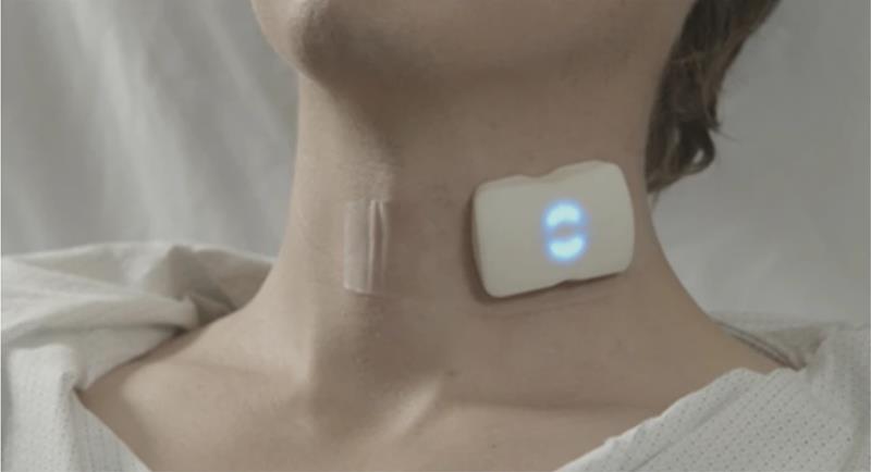 Wearable patch continuously tracks Doppler blood flow metrics in carotid artery