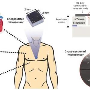 Wearable integrated sensor simultaneously records mechano-acoustic signals