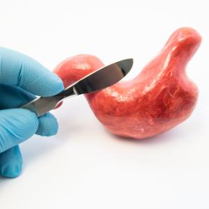 Weight-loss surgery slims down cancer risk in NAFLD patients