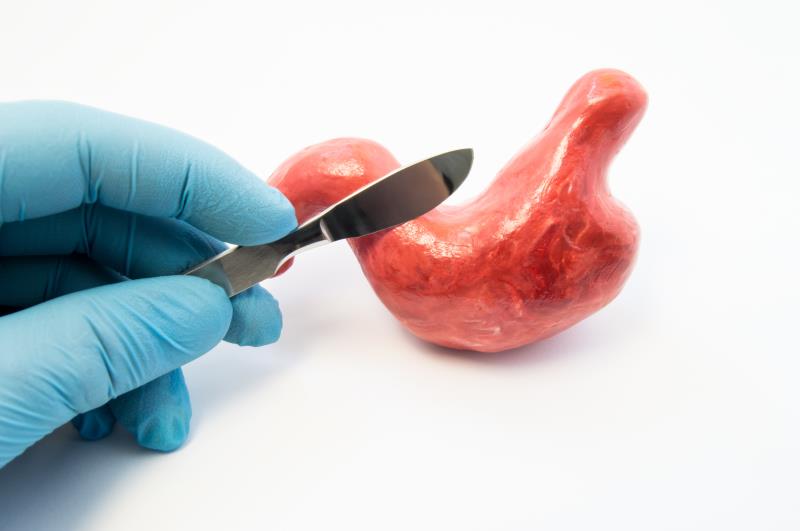 Weight-loss surgery slims down cancer risk in NAFLD patients