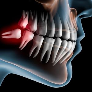 Weak maximum bite force may foreshadow CVD