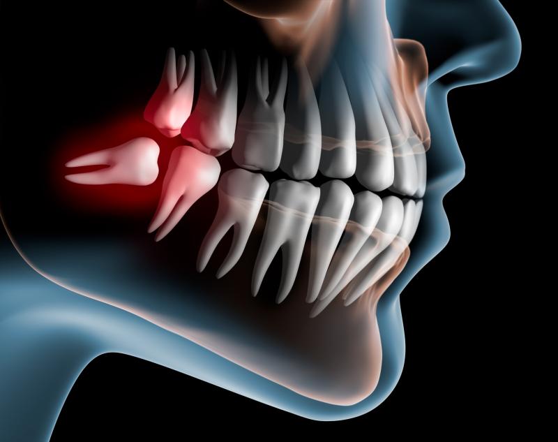 Weak maximum bite force may foreshadow CVD