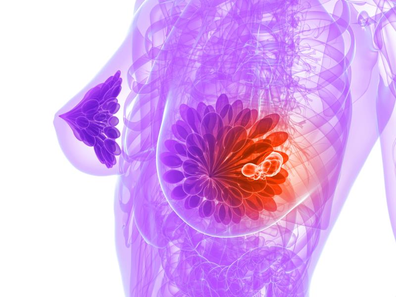 Being tall entails increased breast cancer risk for young women