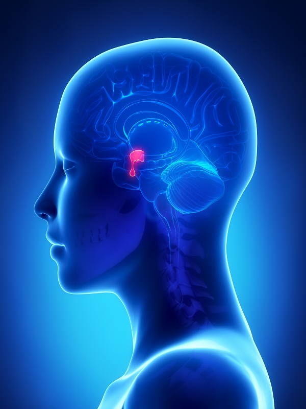 Acromegaly