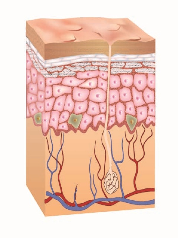 Atopic Dermatitis