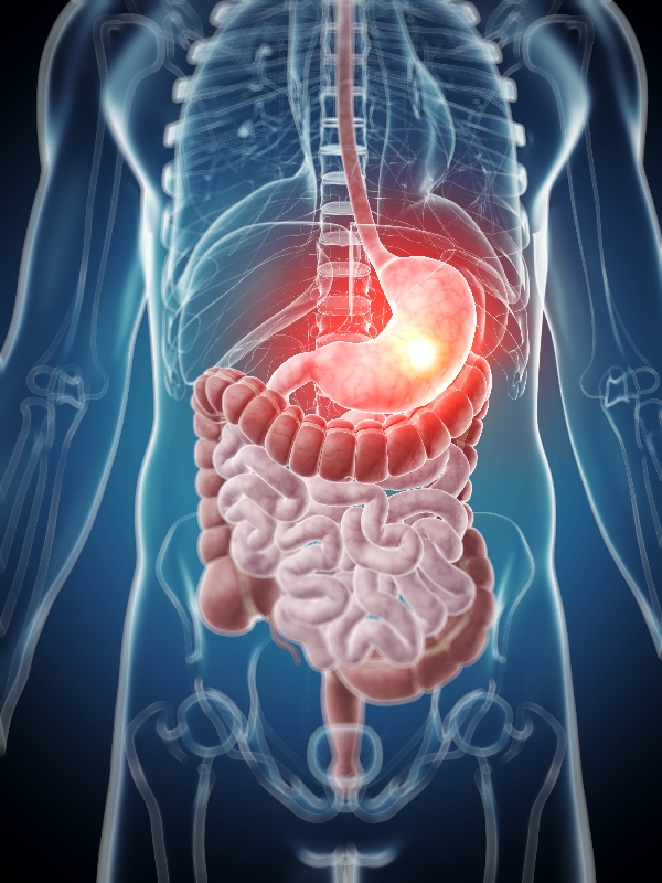 Gastrointestinal Stromal Tumor