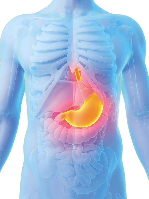 Helicobacter pylori Infection