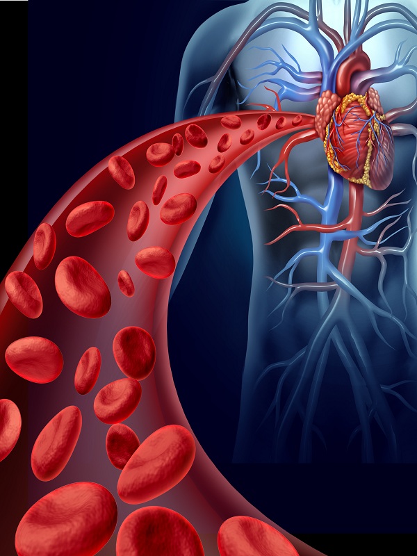 Venous Thromboembolism - Management