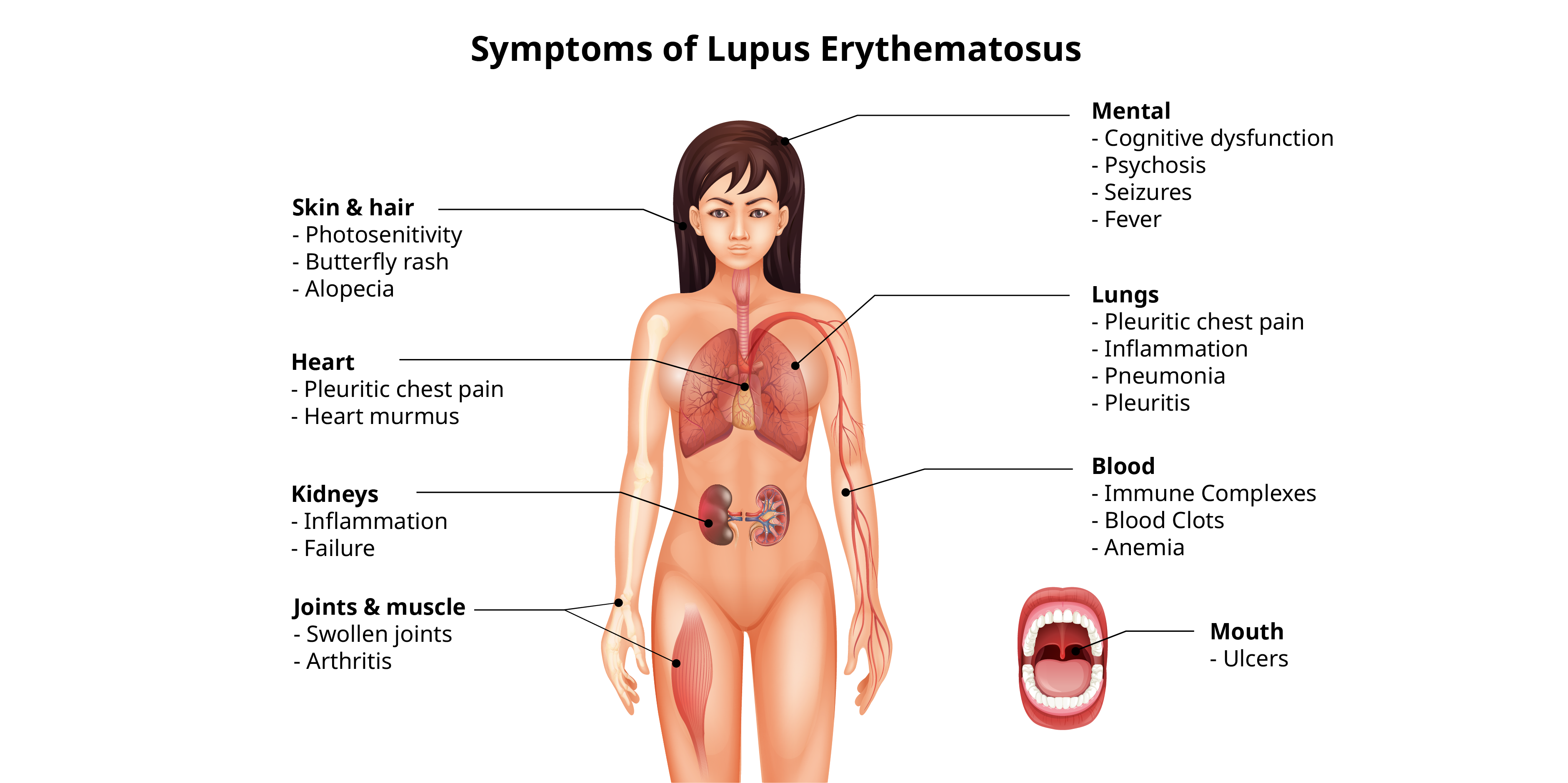 Systemic Lupus Erythematosus_Initial Assessment 1