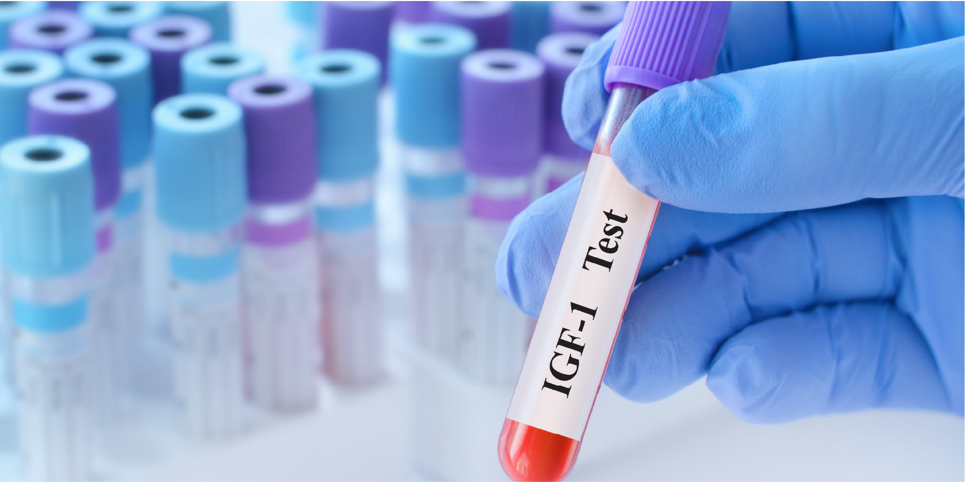 Acromegaly.ai_Diagnostics 1