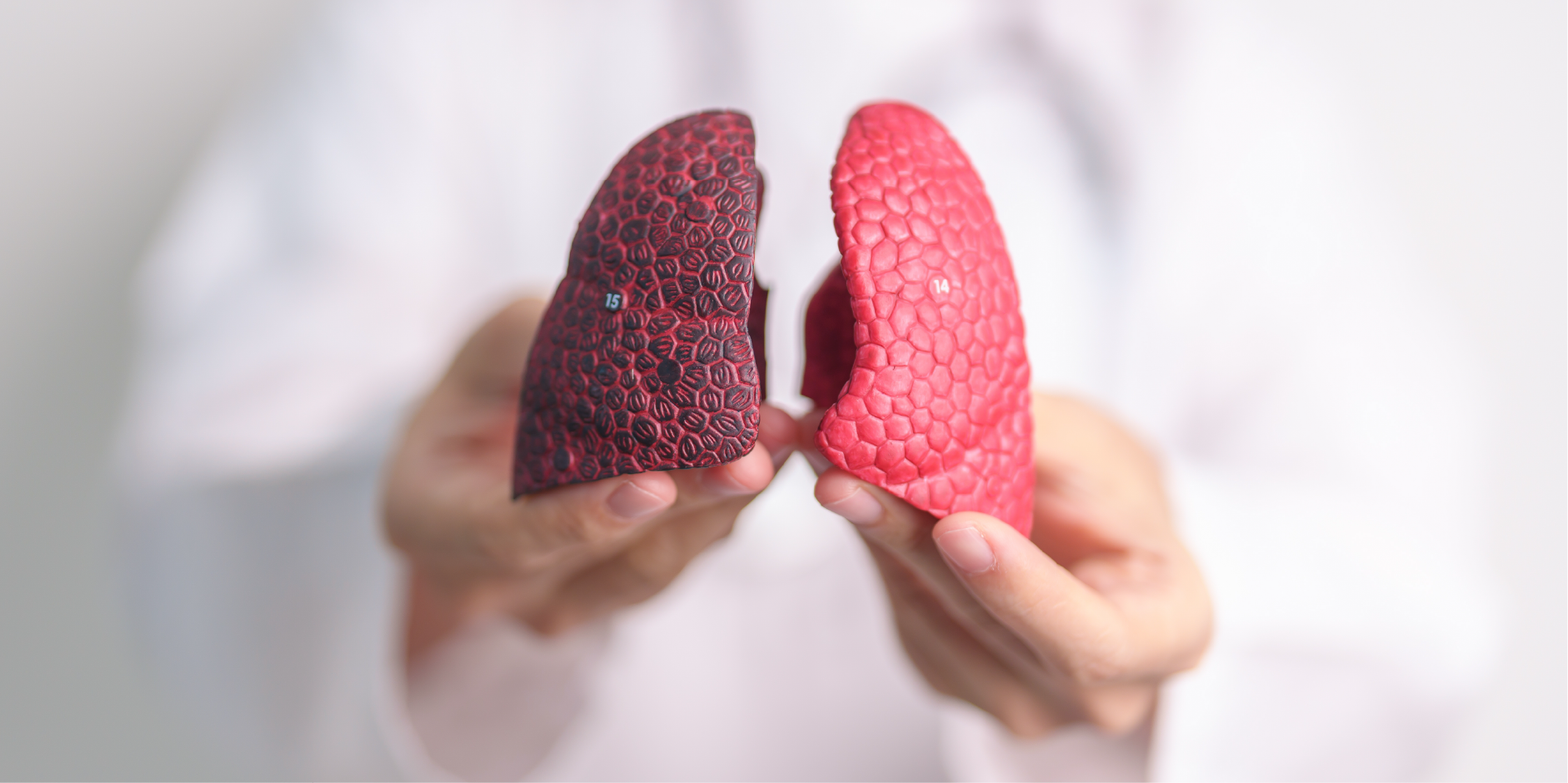 Chronic Obstructive Pulmonary Disease_Disease Summary