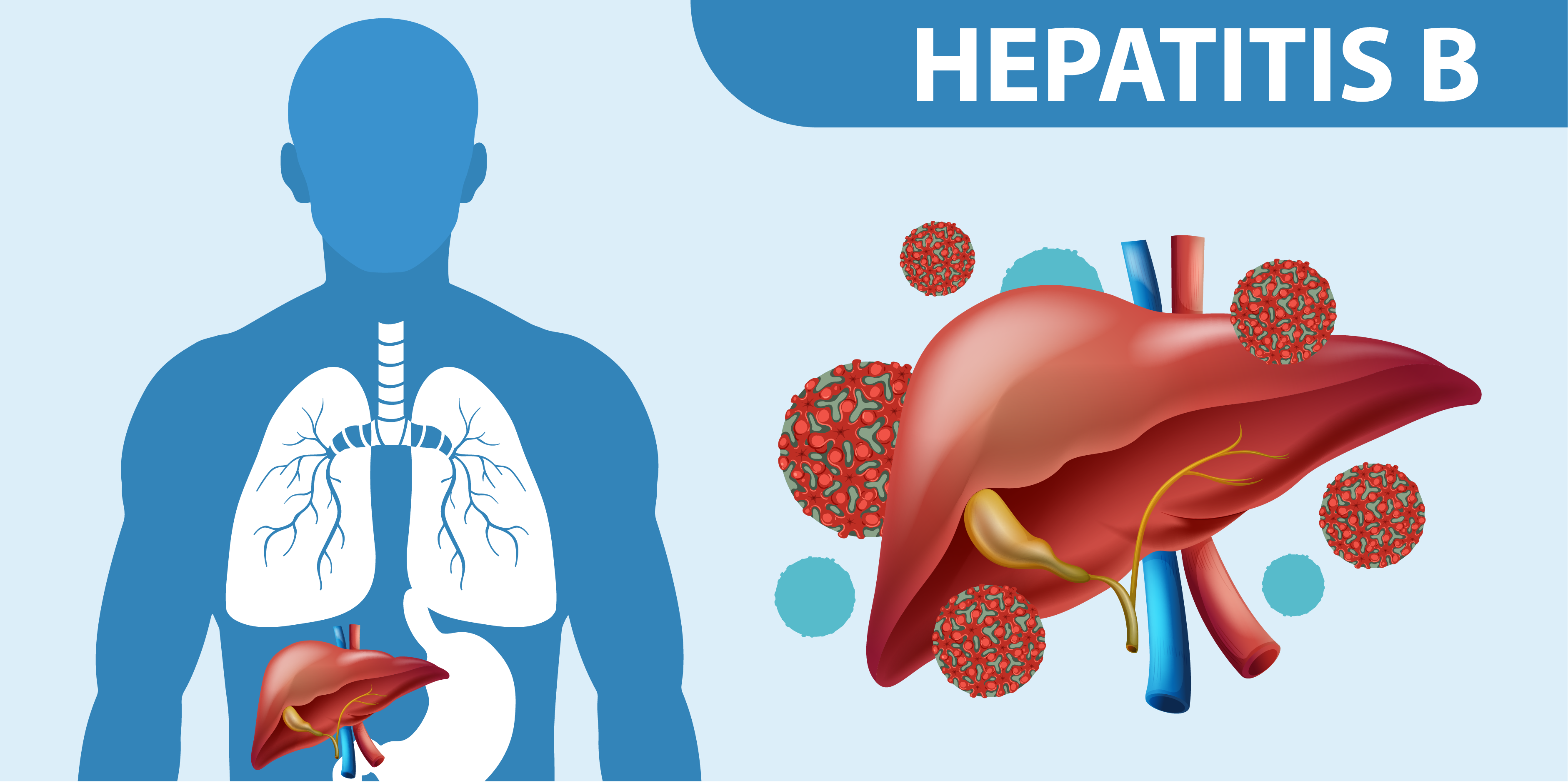 Hepatitis B_Initial Assessment 2