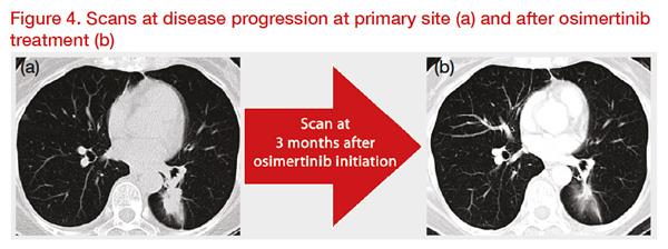 *Clinical images courtesy of Dr Akito Hata.