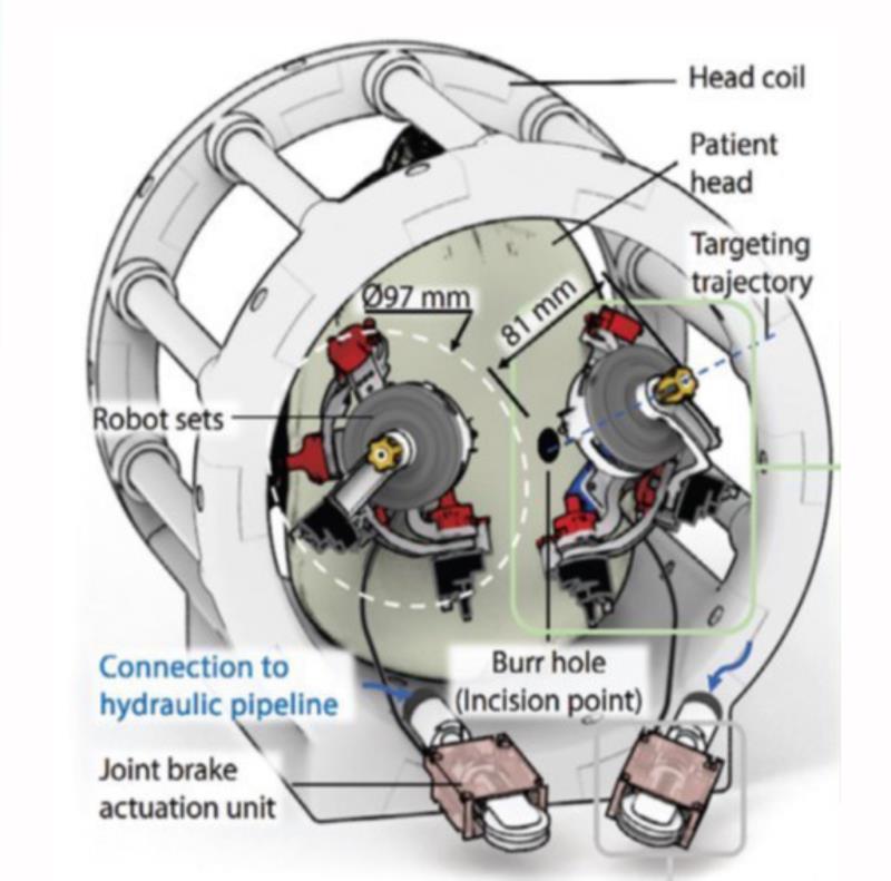 Robotic system implementation within an MRI head coil. Adapted from Adv Sci (Weinh) 2024;11:e2305495