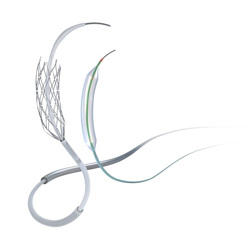 The Wingspan stent (image courtesy of Stryker)