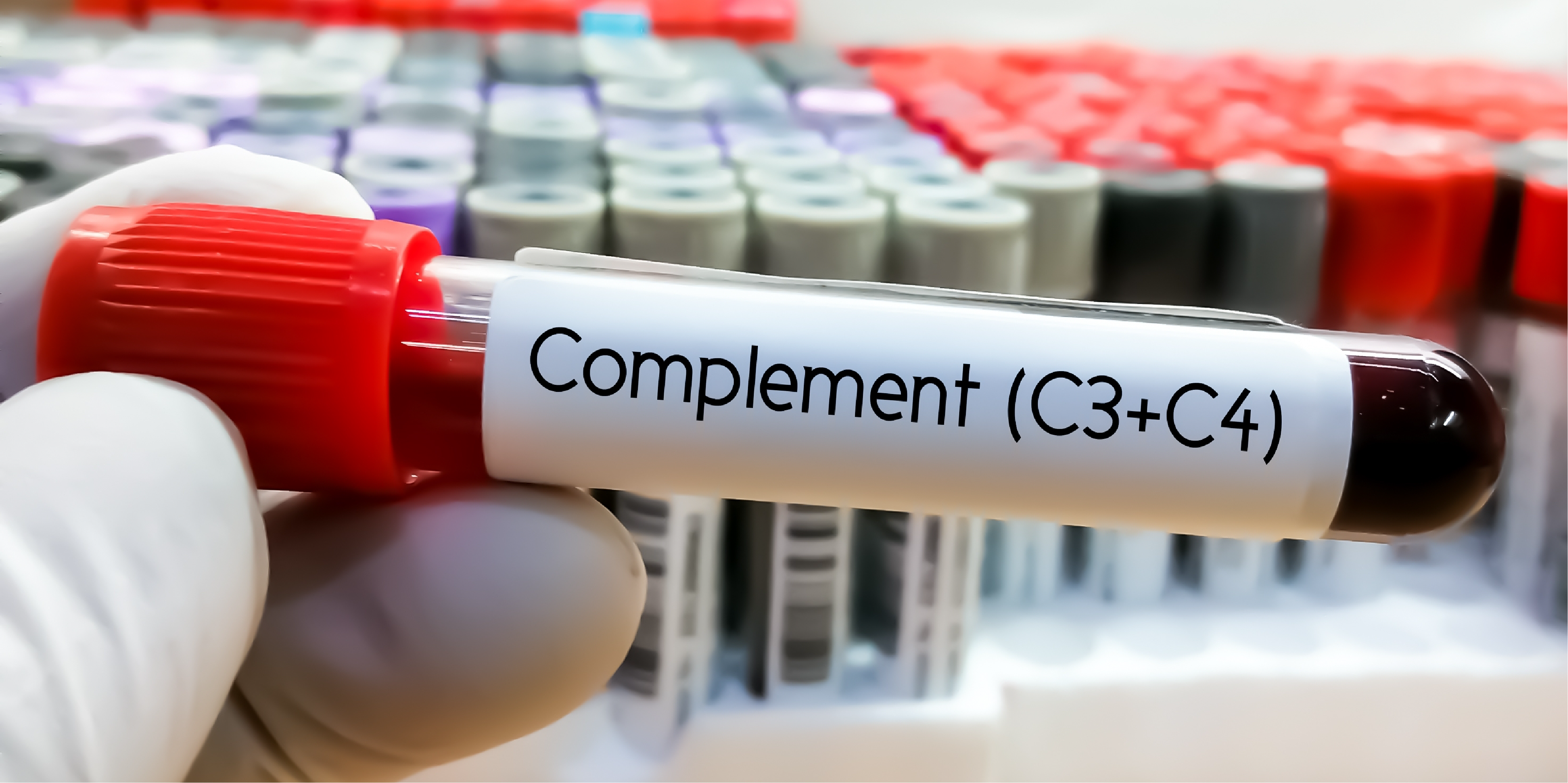 Systemic Lupus Erythematosus_Initial Assessment 3