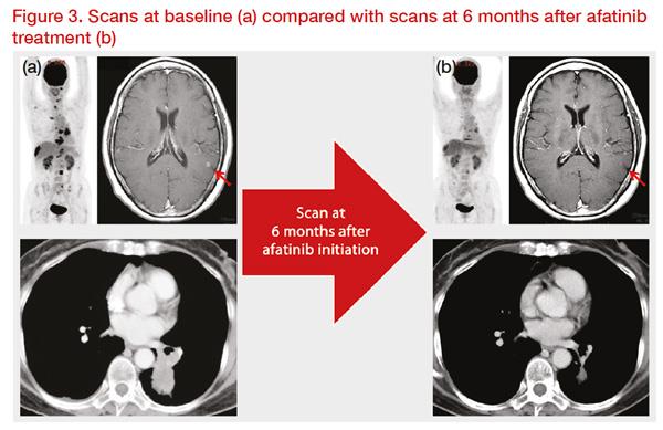 *Clinical images courtesy of Dr Akito Hata.